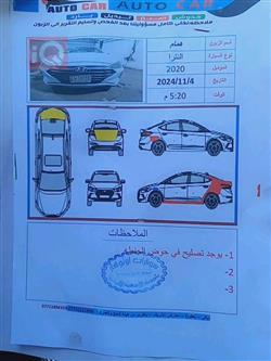 هيونداي النترا